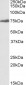 RSL1D1 Antibody (internal region)