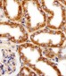 MPP7 Antibody (N-term)