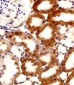 FBXL17 Isoform 2 Antibody (C-term)