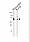 Mouse T Antibody (C-term)
