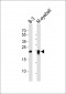 CRYBB2 Antibody (N-term)