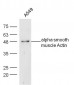 Alpha smooth muscle Actin Antibody