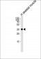 IFNGR2 Antibody (C-term)