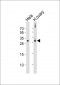 DIRAS3 Antibody