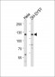 Mouse Ror2 Antibody (C-term)
