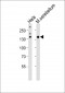 Mouse Kdm6b Antibody (Center)