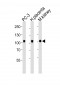 Mouse Ephb4 Antibody (C-term)