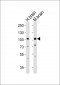 Mouse Epha6 Antibody (C-term)