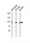 Mouse Epha1 Antibody (N-term)