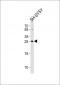 ZDHHC21 Antibody (N-term)