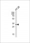 SMYD3 Antibody (Center)