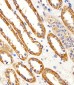 CYS1 Antibody  (C-term)