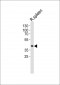 (RAT) Ccnd3 Antibody (N-term)