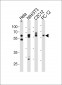 (Mouse) Smad2 Antibody (Center)