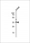 PPAP2A Antibody (C-term)