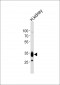 PPAP2A Antibody (C-term)