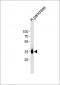 PPAP2A Antibody (C-term)