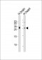 CHMP3 Antibody (N-term)