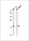 TMEM160 Antibody  (N-term)