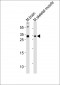 OLIG3 Antibody (N-term)