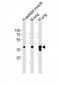 LMCD1 Antibody (C-term)