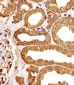 MORC3 Antibody (Center)