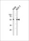 PPP2R2C Antibody (N-term)