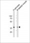 B4GALT7 Antibody (C-term)