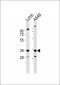 HOXB2 Antibody