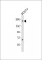 Topoisomerase 2 beta Antibody