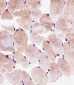 SLC25A25 Antibody (N-term)