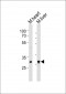 Mouse Hoxb1 Antibody (C-term)