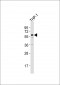 ZNF92 Antibody (N-term)