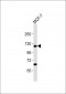 ZNF217 Antibody (N-term)