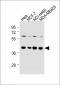 LAPTM4B Antibody