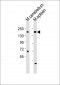 Mouse Kdm6a Antibody (C-term)