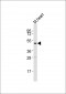Htr2a Antibody (N-term)