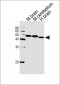 GABRG1 Antibody (C-term)