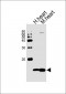 NDUFV3 Antibody (C-term)