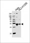 RPL6 Antibody (N-term)