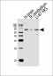 Mouse Camkk2 Antibody (N-term)