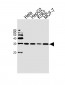 PMM2 Antibody (C-term)