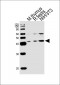 Mouse Tfap2a Antibody (Center)