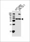 CRTAP Antibody (N-term)