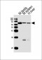 ZNF654 Antibody(C-term)