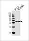 FBXO28 Antibody (C-term)