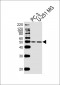 RPLP0P6 Antibody (N-term)