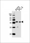 SIRPB1 Antibody (N-term)