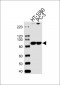 ZNF560 Antibody (Center)
