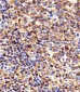 HLA-B Antibody (N-term)